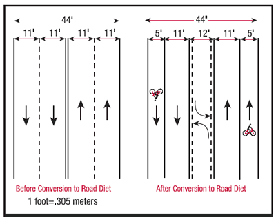 Basic 4-to-3 lane road diet schematic. Source: Federal Hightways Administration